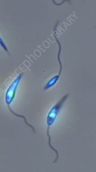 Leishmania major promastigote stages.