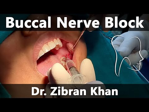 Buccal Nerve Block - Clinical Demonstration on Patient
