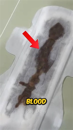 Why Period Blood Changes Color? 😱