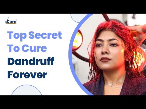 The Best Way To Cure Your Itchy Scalp Forever | Hair Fall Solution | VCare #haircare #vcareclinics