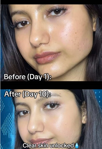 Achieve Clear Skin with PURITO Gel Moisturizer