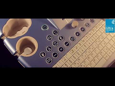 GE Voluson E6 Ultrasound Machine @ ULTRASOUNDINDIA