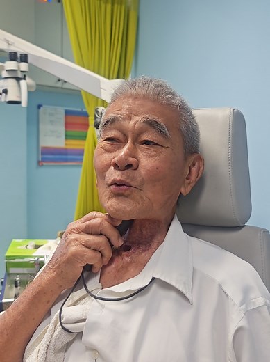 First Experience with Electrolarynx for Voice Restoration