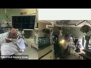 Awake Craniotomy Tips & Technique