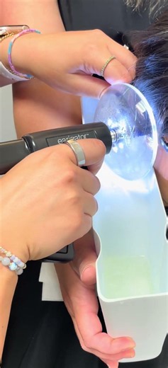 Earwax removal with Earigator #earwaxcleaning #earwaxremoval #audiology