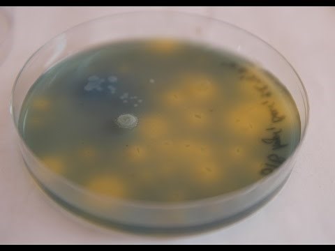 [DIY BIO] How to obtain Acetobacter & making Bromothymol blue Agar