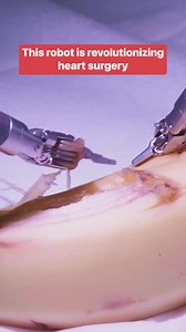 3.1K views · 45 reactions | Dr. Leonard Lee shows us how this robot allows him to repair parts of the body minimally invasively. #surgery #robots #doctors | Business Insider Africa | Facebook