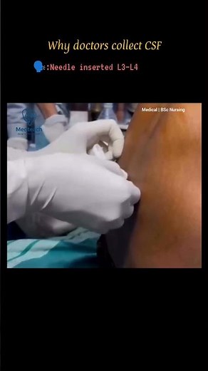 How CSF Is Collected? | Lumbar Puncture & Indications Explained #youtubeshorts