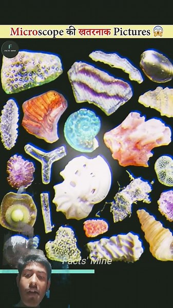 Things That Look Amazing Under The Microscope