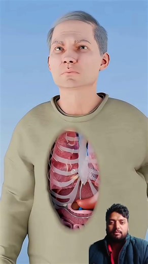 आदमी के फेफड़े से गोली कैसे निकला#shorts