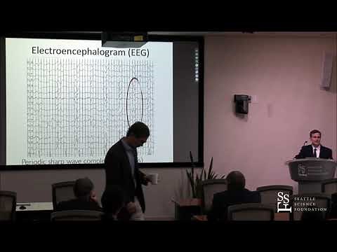 Creutzfeldt-Jakob Disease and Other Prion Diseases - Brian Appleby, M.D.