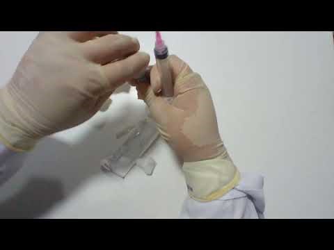 Como preparar o Tramal. Via Intravenosa e Intramuscular.