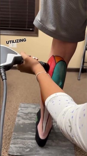 How to treat calf muscle cramps with Shockwave Therapy