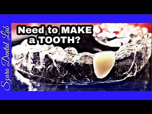 Invisible Retainer Pontic Tooth Lesson #97 Szara Dental