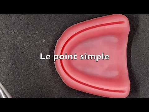 Le point de suture simple