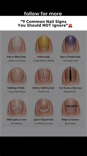 ''9 Common Nails Signs You Should Not Ignore" 🤯