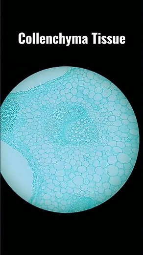 Collenchyma Tissue Under Microscope