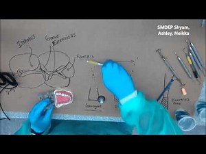 Class 1 Amalgam Restoration