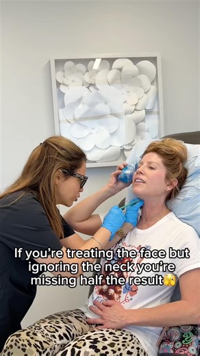✨Botox for the Neck✨