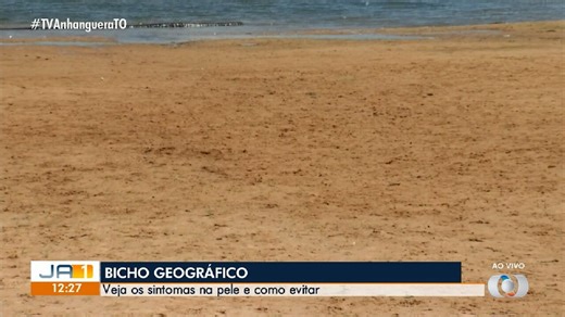 Especialista explica o que é bicho geográfico e quais são os sintomas