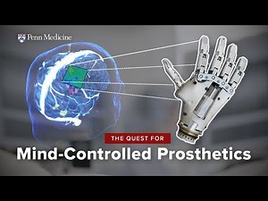 Thought-Controlled Prosthetics: A Brain-Computer Interface Breakthrough