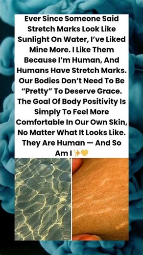 Stretch Marks, Who Cares ✨💛