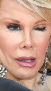 She had HOW MANY? Joan Rivers Had 739 Plastic Surgeries In Her Life #joanrivers #plasticsurgery | Inform Overload