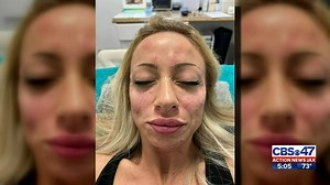 UPDATE, 8/24/2022: The spa owner Dr. Melinda Keener said Monica Daroui claimed there was a misunderstanding and she came back and paid the full bill. ---------- ‘Botox bandit': Woman skips out on her nearly $2,600 botox bill at Jacksonville Beach med spa >>> bit.ly/3whfANz | Action News Jax