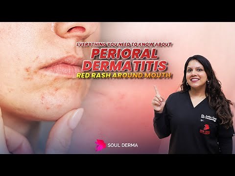 #PerioralDermatitis: Causes, Symptoms & Treatment for Red Rash Around Mouth