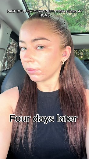 4-Day Lip Transformation Journey Progression