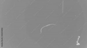 the nematode worm under a microscope