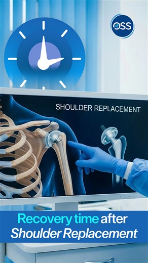 Dr Priyadarshi Amit - Orthopedic Specialist on Instagram: "Shoulder Replacement Recovery: What to Expect? Wondering how long it really takes to get back to your normal life after a shoulder replacement? Here’s a clear breakdown 👇 ✔️ 0–2 months: Focus on regaining shoulder movement with supervised physiotherapy ✔️ 2–4 months: Start strength training to rebuild stability and confidence ✔️ 3–4 months: Resume sports like badminton or golf ✔️ After 2 months: You can safely start driving ✔️ Around 6 