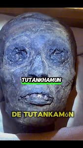 📸 Who Was the Real Tutankhamun?For over 3,000 years, the image of Tutankhamun has puzzled historians and scientists alike.His mummy, now on display, shows a darkened face — but experts suggest this is most likely the result of chemical reactions during the mummification process, not his natural skin color.Inside the Egyptian Museum, a wooden statue of the young pharaoh presents his body painted black and adorned with gold.Yet this was not a portrait of his appearance, but a sacred symbol.In anc