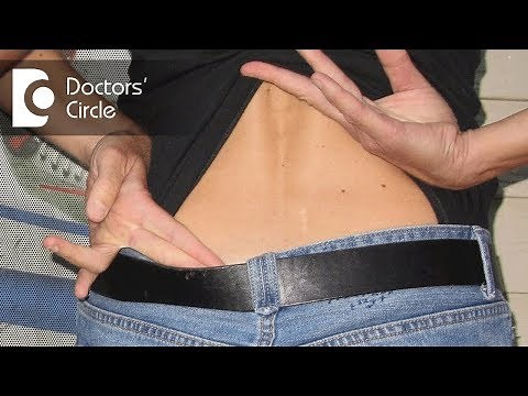 Management of Lumbar Lump after treatment for Potts Spine & Psoas abscess - Dr. Kodlady S Shetty