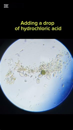 What Acid Does to Microorganisms #microscope #science #microorganisms #waterstudy #chemistry