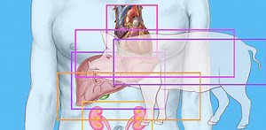 Organs from genetically engineered pigs may help shorten the transplant wait list
