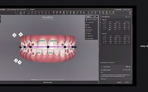 ClinCheck Pro6.0教程2