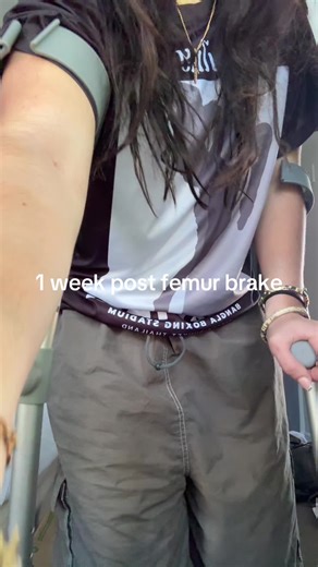 Recovering from a Femur Break in Two Weeks