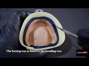 Beading and boxing of maxillary complete denture impression|step by step