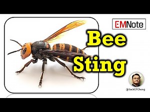 Bee Sting Immediate First Aid
