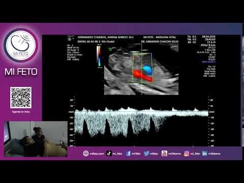 Medicina Materno Fetal - MI FETO