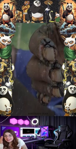 Reach to rescue little legs & Toenails from jigger removal  #fypシ゚ #rescue #rescuedog #rescue #botfly #mangoworm #dog #doglovers #botfly #worm #jigger #jiggerdigging ##toenail #foot #foryou #friend #reel #short | Dr. Vinord Gambia | Facebook