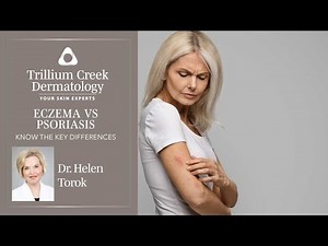 Key differences between eczema and psoriasis