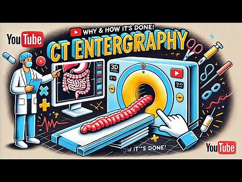 CT Enterography Preparation:Patient Guidelines & Radiology Tips for Beginners| Medical Professionals