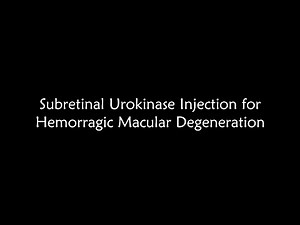 Subretinal Urokinase for hemorrhagic ARMD