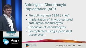 OCD: Beyond Microfracture