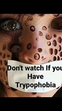 Unraveling Trypophobia: The Science Behind Fear of Small Holes