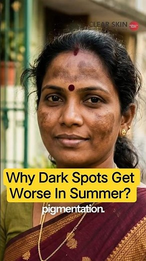 Why Dark Spots Get Worse In Summer? | Hyperpigmentation In Summer | Clear Skin Clinic, Pune