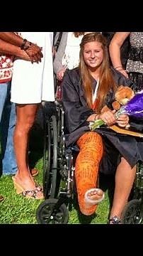 Graduation Full Leg Casts/Long Leg Casts