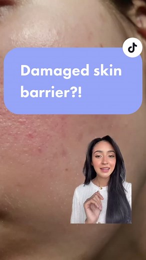 Repair Damaged Skin Barrier with Ultra Repair Cream by First Aid Beauty